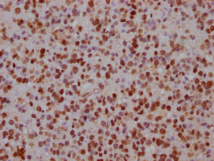 FABP4 Antibody - image 2