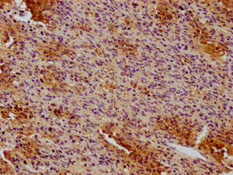 CD19 Monoclonal Antibody - image 3