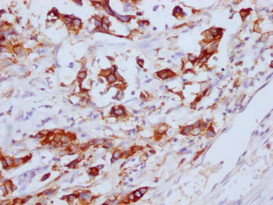 CEACAM5 Monoclonal Antibody - image 3