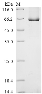 Recombinant Rat Glutamate receptor ionotropic, NMDA 1 (Grin1) , partial - image 1