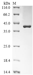 Recombinant Streptococcus pyogenes Exotoxin type A (speA) - image 1
