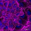 breast cancer cells undergo a stiffening state prior to becoming malignant