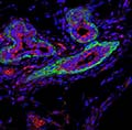 a small RNA molecule helps maintain the activity of stem cells in both healthy and cancerous breast tissue
