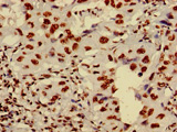 HIST1H4A (Ab-8) Antibody IHC 01