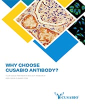 Antibody Introduction Brochure