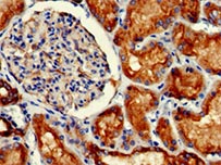 IHC validation of PODXL antibody