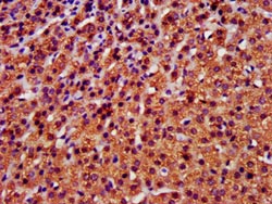IHC image of A antibody diluted at 1:400 