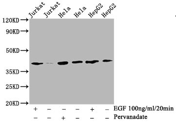 WB application of Phospho-LAT antibody