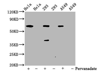 WB application of Phospho-SHP2 antibody