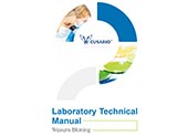 Western Blotting(WB) Protocol