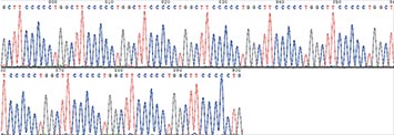 Gene Synthesis case {GCTTCCCCCTG}10