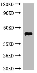 Western Blot-His