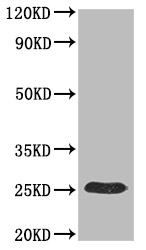 Western Blot-His