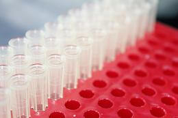 Modified red blood cells prevents harmful immune response