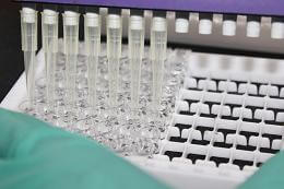 Lack of IL-33 contributes to Alzheimer's disease