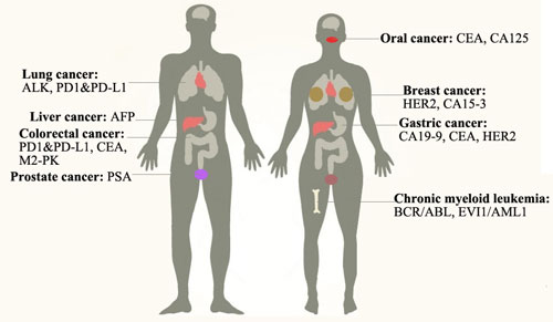 Commonly Used Tumor Markers for Cancers