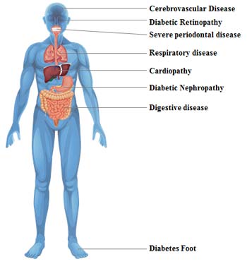 A series of chronic diseases of the heart, brain, kidney, retina and nervous system caused by diabetes.