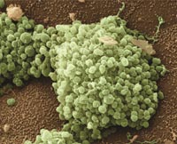 the image of gonorrhea