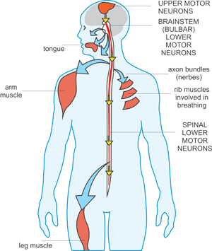 upper and lower motor neuron