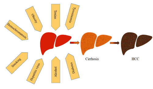 The impact factors and processes of HCC