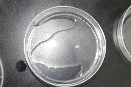 Preventing brain tumors from repairing themselves by blocking a protein