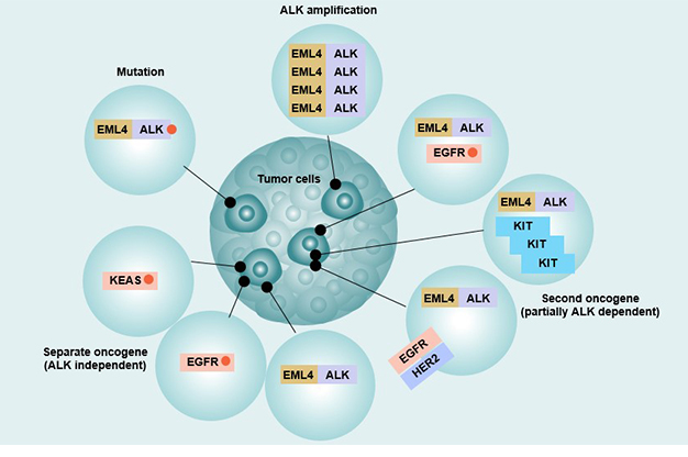 Resistance Mechanism of EML4-ALK