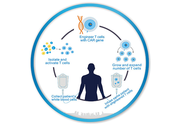 the processes of CAR-T cell therapy