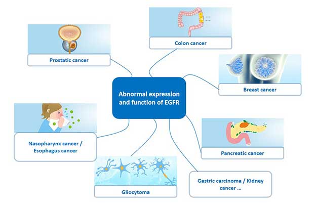 Cancer associated with abnormal expression of EGFR