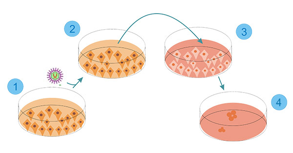A scheme of the generation of IPS cells.