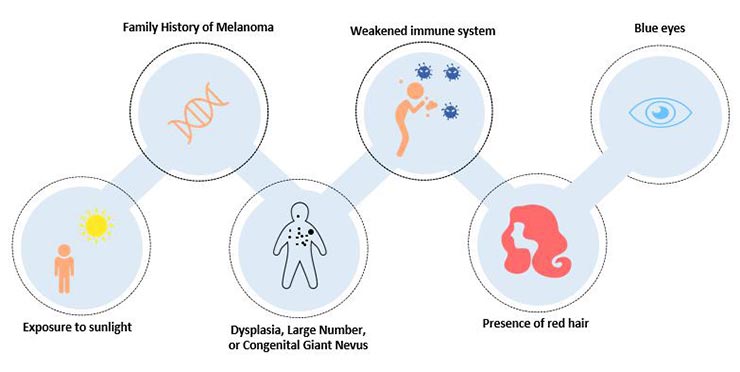 Risk factors of melanoma