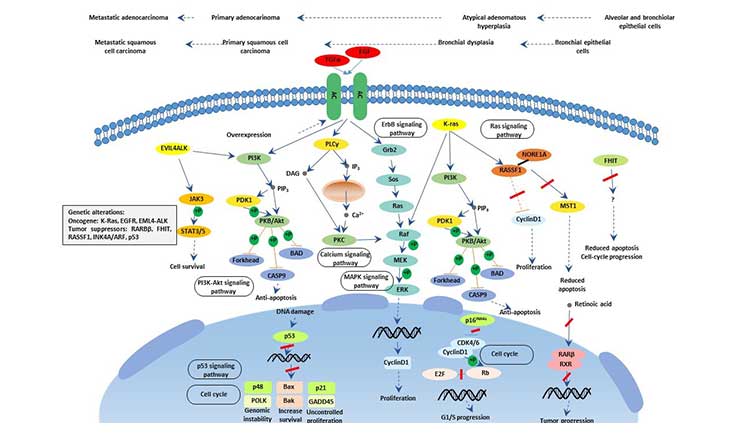 the diagram of NSCLC signaling pathway