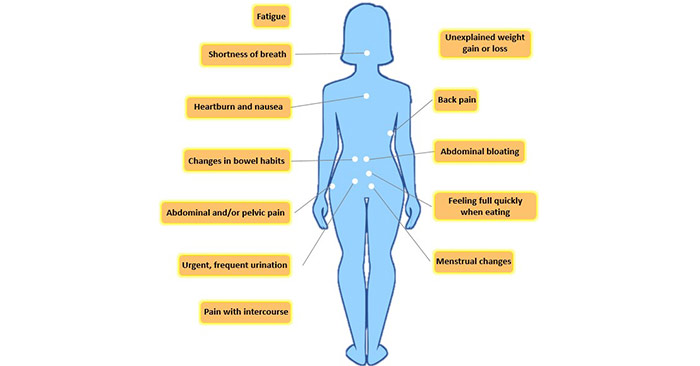 Sign and symptom of ovarian cancer