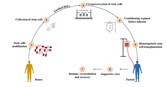 Hematopoietic cell transplantation (HCT)