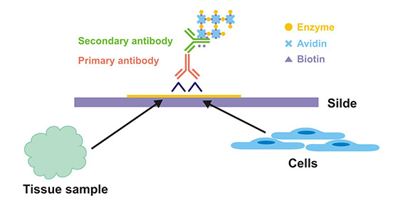 The Application of IHC in Pathological Diagnosis