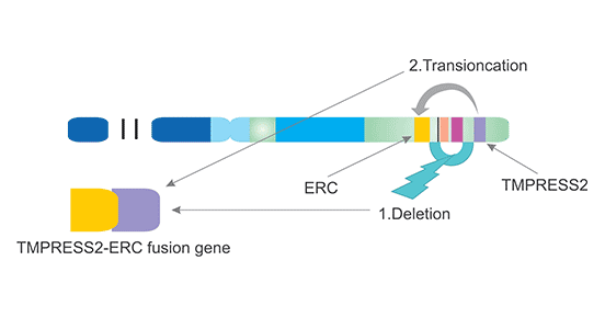 Mechanism of TMPRESS2-ERG fusion (chromosome 21)