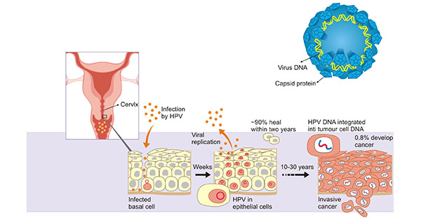 How HPV damages cells
