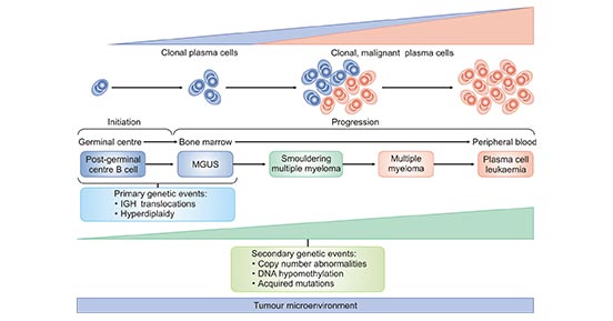 Multiple Myeloma, One of High-Risk Factors for COVID-19