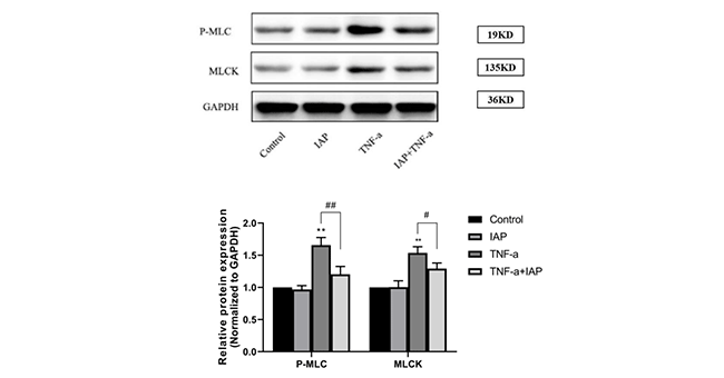 Effects of 2IAP on MLCK/pMLC signal paths