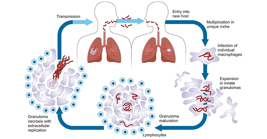 Pathogenic life cycle of M. tuberculosis