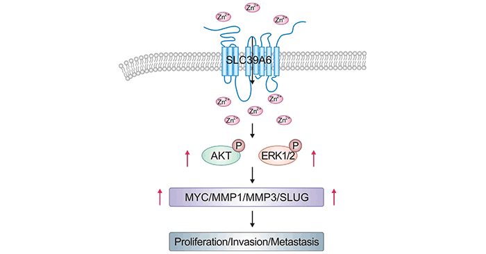 SLC39A6 promotes ESCC via AKT and ERK pathways