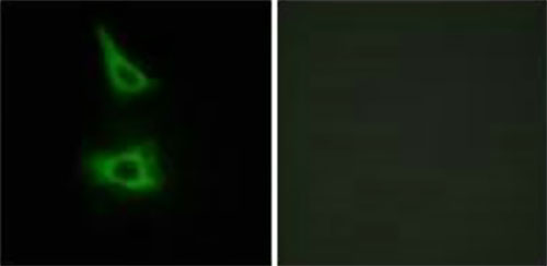 CDH17 Antibody IF