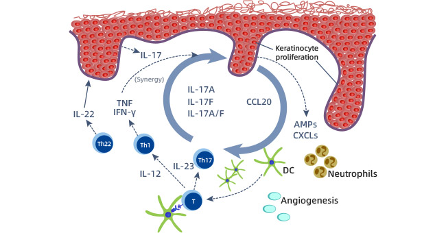 IL-17A: A Major Cytokine of the IL-17 Family, a Key Inflammation Target in Skin Diseases, or Inflammation-Associated Cancers!