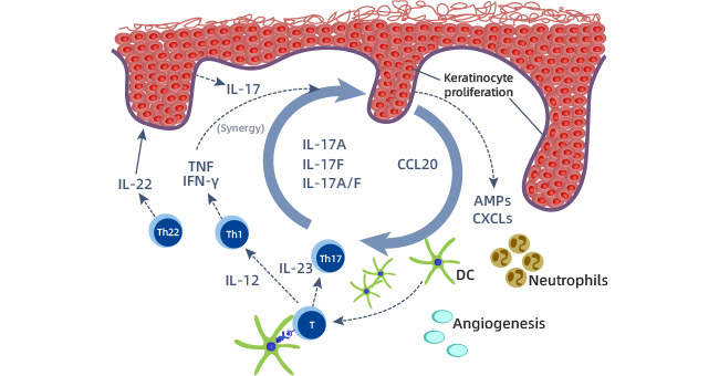 IL-17A regulates cytokines or chemokines in psoriasis