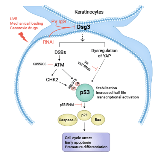 DSG3: An Emerging Tumor-Associated Adhesion Factor, a Specific Marker for the Clinical Diagnosis of Pemphigus Vulgaris (PV)!