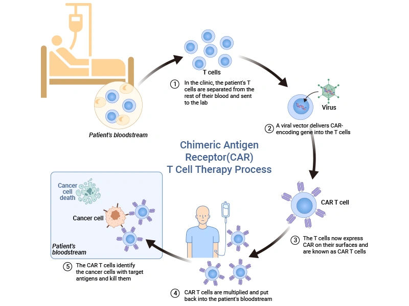 Schematic representation of the main process of CAR-T cell therapy