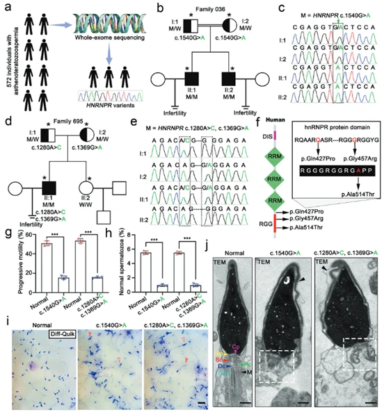 HNRNPR gene mutations cause asthenoteratozoospermia and male infertility