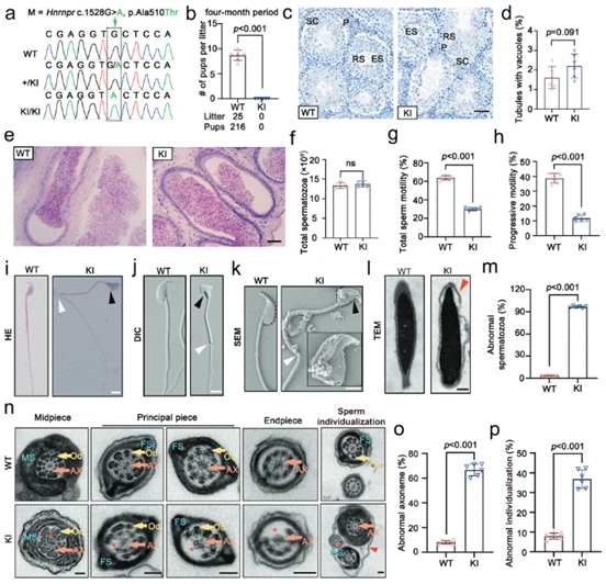 Hnrnpr gene mutation leads to asthenoteratozoospermia and male infertility in mice