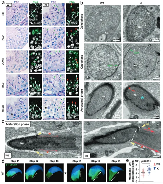 Abnormalities in acrosome, nucleus, and manchette assembly in gene knock-in mouse sperm