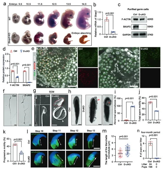 SKAP2 deficiency interferes with spermatogenesis and causes sperm malformation