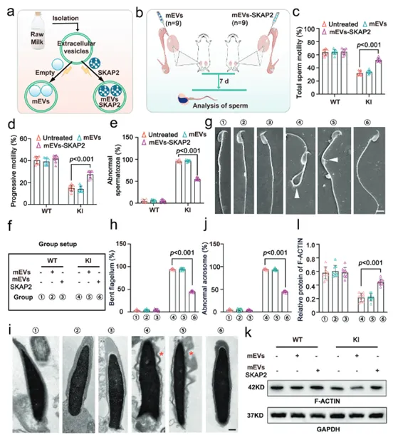 Extracellular vesicle-SKAP2 restores sperm motility and morphology in Hnrnpr mutant mice